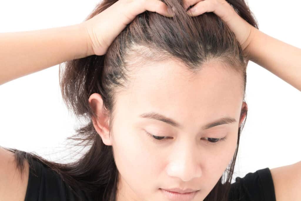 sampon protiv opadanja kose